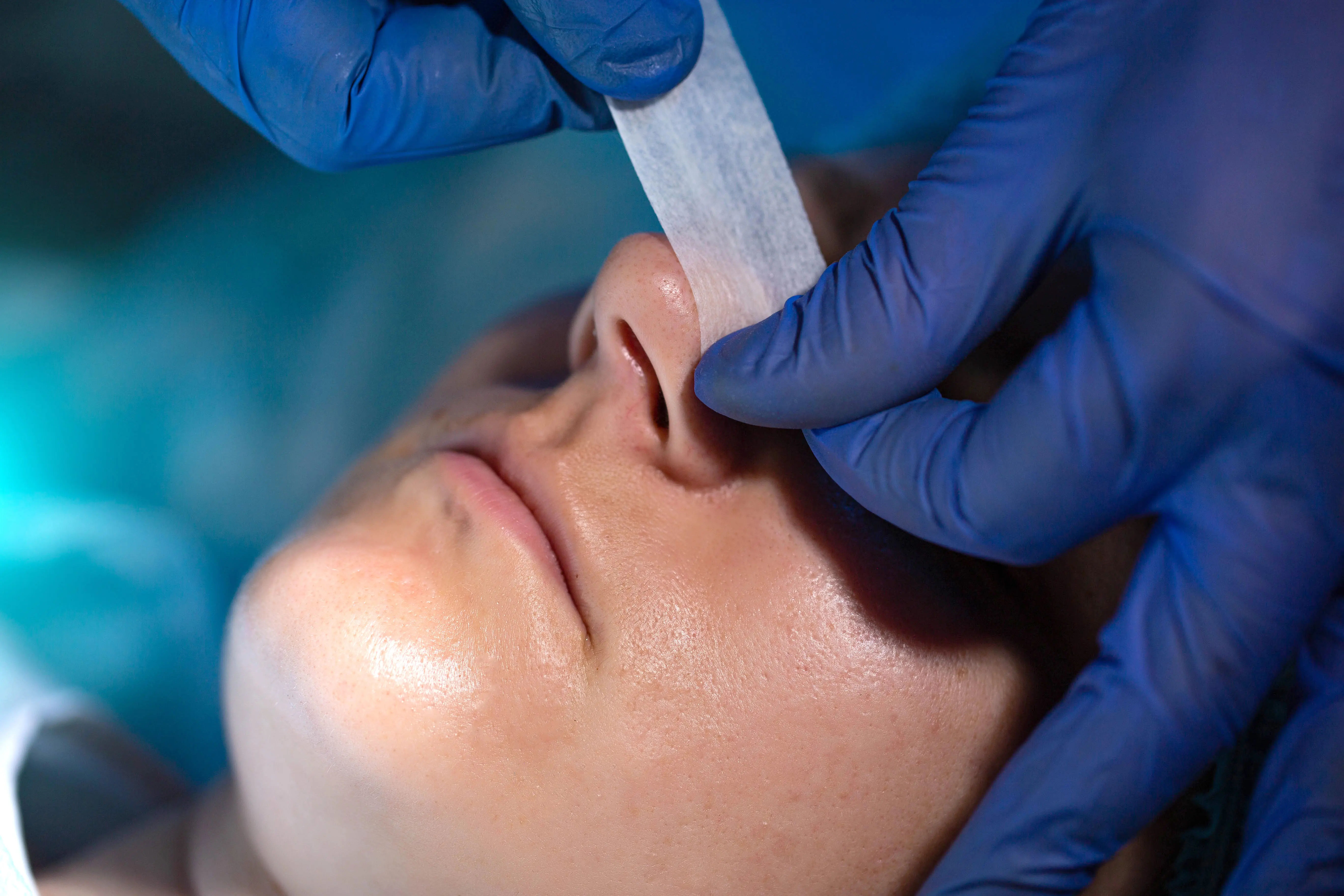 Septoplasty Relief for a Deviated Septum